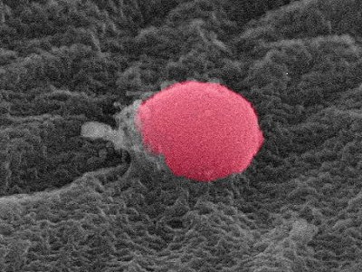 Partícula de SiO2 sobre una célula